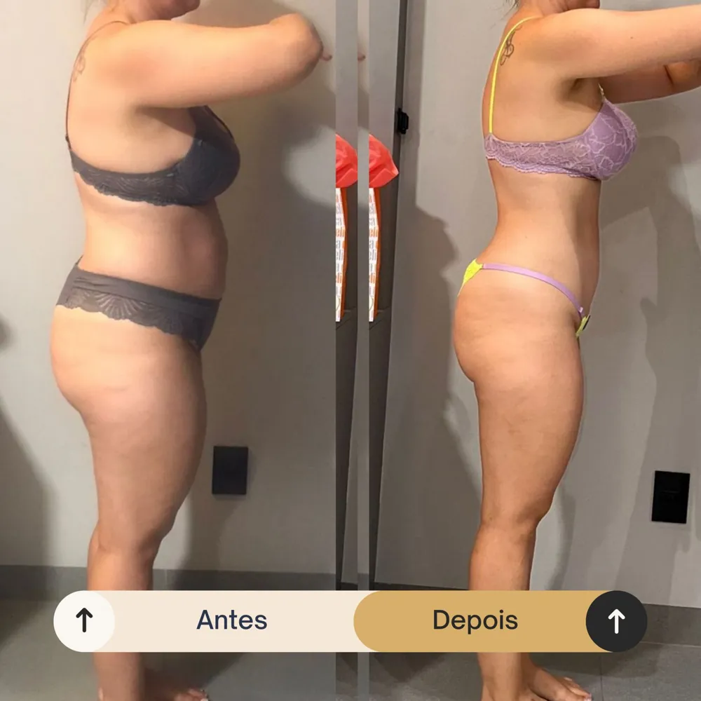 Antes e depois de aluna da RO Training