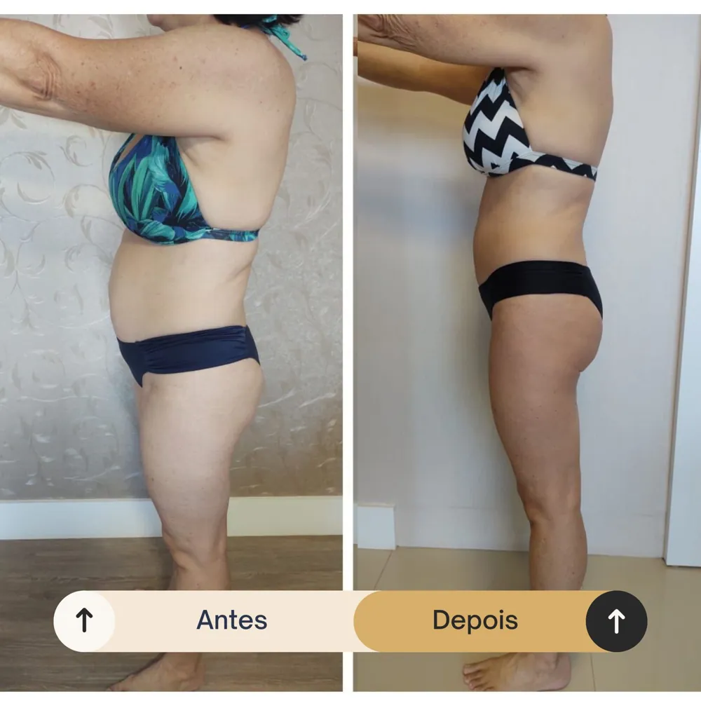 Antes e depois de aluna da RO Training